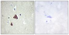 ADCY8 / Adenylate Cyclase 8 Antibody - Immunohistochemistry analysis of paraffin-embedded human brain tissue, using ADCY8 Antibody. The picture on the right is blocked with the synthesized peptide.
