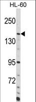 ADCY8 / Adenylate Cyclase 8 Antibody - Western blot of ADCY8 Antibody in HL-60 cell line lysates (35 ug/lane). ADCY8 (arrow) was detected using the purified antibody.