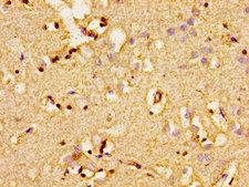 ADCY8 / Adenylate Cyclase 8 Antibody - Immunohistochemistry image of paraffin-embedded human brain tissue at a dilution of 1:100