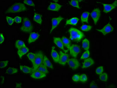 ADCY8 / Adenylate Cyclase 8 Antibody - Immunofluorescence staining of A549 cells with ADCY8 Antibody at 1:233, counter-stained with DAPI. The cells were fixed in 4% formaldehyde, permeabilized using 0.2% Triton X-100 and blocked in 10% normal Goat Serum. The cells were then incubated with the antibody overnight at 4°C. The secondary antibody was Alexa Fluor 488-congugated AffiniPure Goat Anti-Rabbit IgG(H+L).