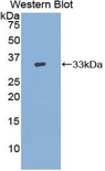 ADCY9 / Adenylate Cyclase 9 Antibody - Western blot of recombinant ADCY9 / Adenylate Cyclase 9.  This image was taken for the unconjugated form of this product. Other forms have not been tested.