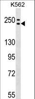 ADCY9 / Adenylate Cyclase 9 Antibody - ADCY9 Antibody western blot of K562 cell line lysates (35 ug/lane). The ADCY9 antibody detected the ADCY9 protein (arrow).