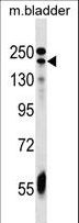 ADCY9 / Adenylate Cyclase 9 Antibody - ADCY9 Antibody western blot of mouse bladder tissue lysates (35 ug/lane). The ADCY9 antibody detected the ADCY9 protein (arrow).