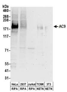 ADCY9 / Adenylate Cyclase 9 Antibody - Detection of human and mouse AC9 by western blot. Samples: Whole cell lysate (50 µg) from HeLa, HEK293T, Jurkat, mouse TCMK-1, and mouse NIH 3T3 cells prepared using NETN and RIPA lysis buffer. Antibodies: Affinity purified rabbit anti-AC9 antibody used for WB at 0.1 µg/ml. Detection: Chemiluminescence with an exposure time of 30 seconds.