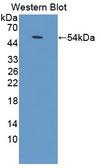 ADCY9 / Adenylate Cyclase 9 Antibody - Western blot of ADCY9 / Adenylate Cyclase 9 antibody.