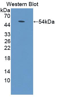 ADCY9 / Adenylate Cyclase 9 Antibody - Western blot of ADCY9 / Adenylate Cyclase 9 antibody.