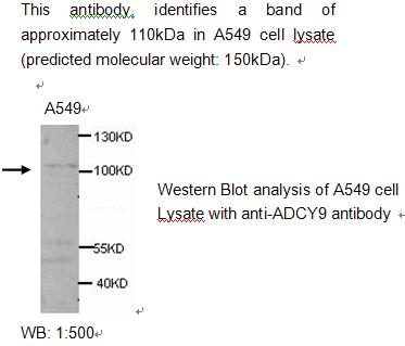 ADCY9 / Adenylate Cyclase 9 Antibody