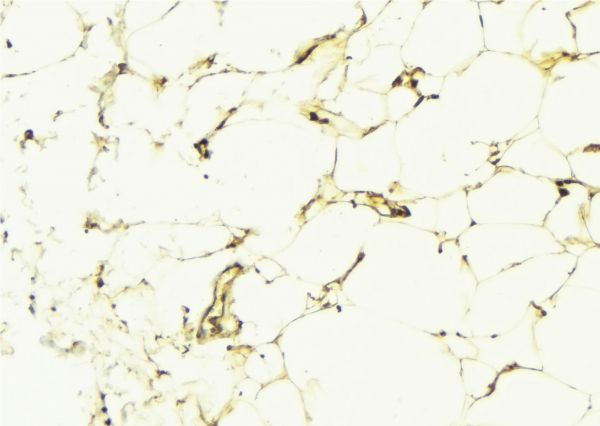 ADCY9 / Adenylate Cyclase 9 Antibody - 1:100 staining human lung tissue by IHC-P. The sample was formaldehyde fixed and a heat mediated antigen retrieval step in citrate buffer was performed. The sample was then blocked and incubated with the antibody for 1.5 hours at 22°C. An HRP conjugated goat anti-rabbit antibody was used as the secondary.