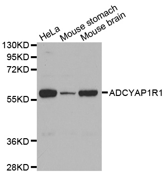 ADCYAP1R1 / PAC1 Receptor Antibody - Western blot analysis of extracts of various cell lines, using ADCYAP1R1 antibody. (1: HeLa cell lysate 2: Mouse stomach tissue lysate 3: Brain tissue lysate).