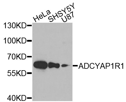 ADCYAP1R1 / PAC1 Receptor Antibody - Western blot analysis of extracts of various cells.