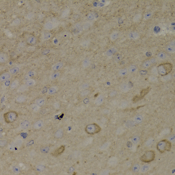 ADCYAP1R1 / PAC1 Receptor Antibody - Immunohistochemistry of paraffin-embedded mouse brain tissue.