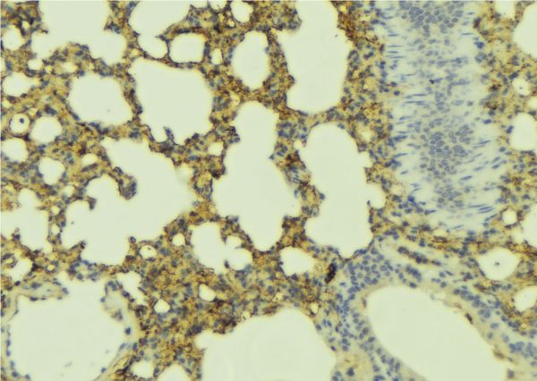 ADCYAP1R1 / PAC1 Receptor Antibody - 1:100 staining mouse lung tissue by IHC-P. The sample was formaldehyde fixed and a heat mediated antigen retrieval step in citrate buffer was performed. The sample was then blocked and incubated with the antibody for 1.5 hours at 22°C. An HRP conjugated goat anti-rabbit antibody was used as the secondary.