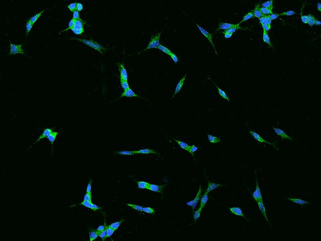 ADCYAP1R1 / PAC1 Receptor Antibody - Immunofluorescence staining of ADCYAP1R1 in SHSY5Y cells. Cells were fixed with 4% PFA, permeabilzed with 0.1% Triton X-100 in PBS, blocked with 10% serum, and incubated with rabbit anti-Human ADCYAP1R1 polyclonal antibody (dilution ratio 1:200) at 4°C overnight. Then cells were stained with the Alexa Fluor 488-conjugated Goat Anti-rabbit IgG secondary antibody (green) and counterstained with DAPI (blue). Positive staining was localized to Cytoplasm.