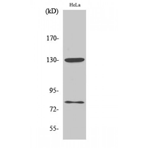 ADD1 + ADD2 Antibody - Western blot of Phospho-Adducin alpha/beta (S726/713) antibody