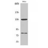 ADD1 + ADD2 Antibody - Western blot of Phospho-Adducin alpha/beta (S726/713) antibody