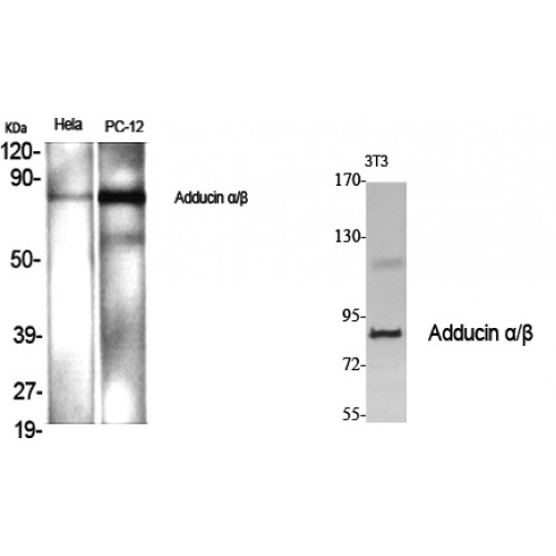 ADD1 + ADD2 Antibody - Western blot of Adducin alpha/beta antibody