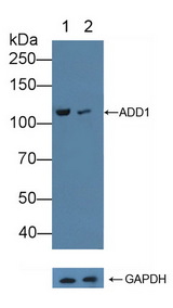 ADD1 / Adducin Alpha Antibody - Knockout Varification: Lane 1: Wild-type K562 cell lysate; Lane 2: ADD1 knockout K562 cell lysate; Predicted MW: 70,81kd Observed MW: 120kd Primary Ab: 1µg/ml Rabbit Anti-Mouse ADD1 Antibody Second Ab: 0.2µg/mL HRP-Linked Caprine Anti-Rabbit IgG Polyclonal Antibody