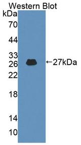 ADD1 / Adducin Alpha Antibody - Western blot of ADD1 / Adducin Alpha antibody.