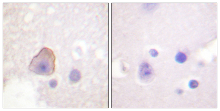 ADD1 / Adducin Alpha Antibody - Immunohistochemistry analysis of paraffin-embedded human brain tissue, using ADD1 Antibody. The picture on the right is blocked with the synthesized peptide.