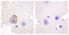 ADD1 / Adducin Alpha Antibody - Immunohistochemistry analysis of paraffin-embedded human brain tissue, using ADD1 Antibody. The picture on the right is blocked with the synthesized peptide.
