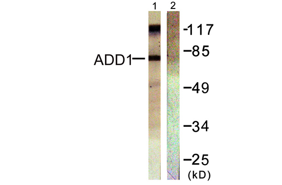 ADD1 / Adducin Alpha Antibody - Western blot analysis of lysates from HeLa cells, treated with Forskolin 40nM 30', using ADD1 Antibody. The lane on the right is blocked with the synthesized peptide.