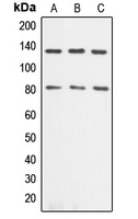 ADD1 / Adducin Alpha Antibody - Western blot analysis of Alpha-adducin expression in Jurkat (A); HeLa (B); NIH3T3 (C) whole cell lysates.