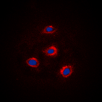 ADD1 / Adducin Alpha Antibody - Immunofluorescent analysis of Alpha-adducin staining in HEK293 cells. Formalin-fixed cells were permeabilized with 0.1% Triton X-100 in TBS for 5-10 minutes and blocked with 3% BSA-PBS for 30 minutes at room temperature. Cells were probed with the primary antibody in 3% BSA-PBS and incubated overnight at 4 deg C in a humidified chamber. Cells were washed with PBST and incubated with a DyLight 594-conjugated secondary antibody (red) in PBS at room temperature in the dark. DAPI was used to stain the cell nuclei (blue).