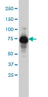 ADD1 / Adducin Alpha Antibody - ADD1 monoclonal antibody (M01), clone 2C9 Western blot of ADD1 expression in IMR-32.