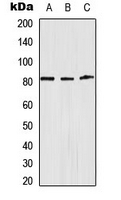 ADD1 / Adducin Alpha Antibody - Western blot analysis of Alpha-adducin expression in HeLa (A); Raw264.7 (B); rat brain (C) whole cell lysates.