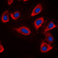 ADD1 / Adducin Alpha Antibody - Immunofluorescent analysis of Alpha-adducin staining in HeLa cells. Formalin-fixed cells were permeabilized with 0.1% Triton X-100 in TBS for 5-10 minutes and blocked with 3% BSA-PBS for 30 minutes at room temperature. Cells were probed with the primary antibody in 3% BSA-PBS and incubated overnight at 4 C in a humidified chamber. Cells were washed with PBST and incubated with a DyLight 594-conjugated secondary antibody (red) in PBS at room temperature in the dark. DAPI was used to stain the cell nuclei (blue).