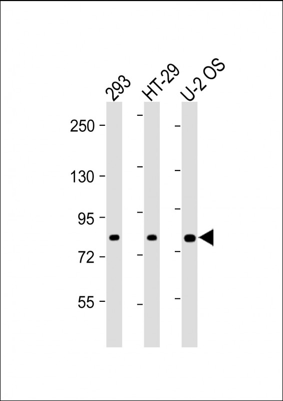 ADD1 / Adducin Alpha Antibody - All lanes: Anti-ADD1 Antibody (Center) at 1:2000 dilution Lane 1: 293 whole cell lysate Lane 2: HT-29 whole cell lysate Lane 3: U-2 OS whole cell lysate Lysates/proteins at 20 µg per lane. Secondary Goat Anti-Rabbit IgG, (H+L), Peroxidase conjugated at 1/10000 dilution. Predicted band size: 81 kDa Blocking/Dilution buffer: 5% NFDM/TBST.