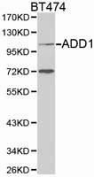 ADD1 / Adducin Alpha Antibody - Western blot of extracts of BT474 cell lines, using ADD1 antibody.