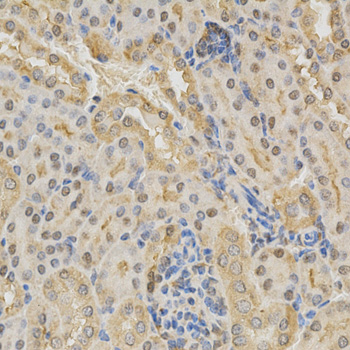 ADD1 / Adducin Alpha Antibody - Immunohistochemistry of paraffin-embedded mouse kidney tissue.