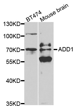 ADD1 / Adducin Alpha Antibody - Western blot analysis of extracts of various cell lines, using ADD1 antibody at 1:500 dilution. The secondary antibody used was an HRP Goat Anti-Rabbit IgG (H+L) at 1:10000 dilution. Lysates were loaded 25ug per lane and 3% nonfat dry milk in TBST was used for blocking.