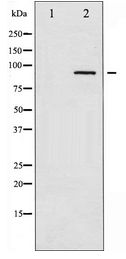 ADD1 / Adducin Alpha Antibody - Western blot of ADD1 expression in Forskolin treated HeLa whole cell lysates,The lane on the left is treated with the antigen-specific peptide.