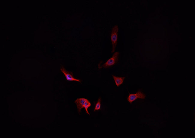 ADD1 / Adducin Alpha Antibody - Staining HeLa cells by IF/ICC. The samples were fixed with PFA and permeabilized in 0.1% Triton X-100, then blocked in 10% serum for 45 min at 25°C. The primary antibody was diluted at 1:200 and incubated with the sample for 1 hour at 37°C. An Alexa Fluor 594 conjugated goat anti-rabbit IgG (H+L) Ab, diluted at 1/600, was used as the secondary antibody.