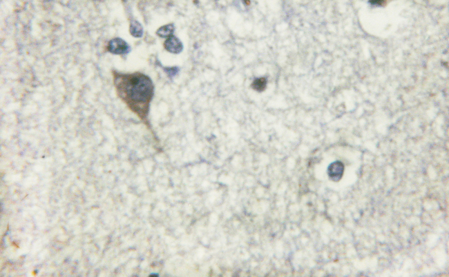 ADD1 / Adducin Alpha Antibody - 1/100 staining human brain tissue by IHC-P. The sample was formaldehyde fixed and a heat mediated antigen retrieval step in citrate buffer was performed. The sample was then blocked and incubated with the antibody for 1.5 hours at 22°C. An HRP conjugated goat anti-rabbit antibody was used as the secondary antibody.