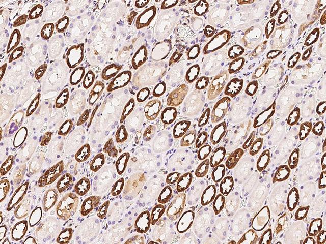 ADD1 / Adducin Alpha Antibody - Immunochemical staining of human ADD1 in human kidney with rabbit polyclonal antibody at 1:300 dilution, formalin-fixed paraffin embedded sections.