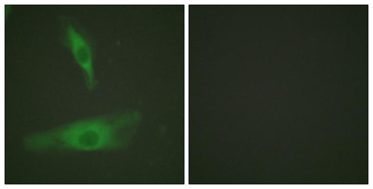 ADD1 / Adducin Alpha Antibody - Peptide - + Immunofluorescence analysis of HeLa cells, using ADD1 (Ab-726) antibody.