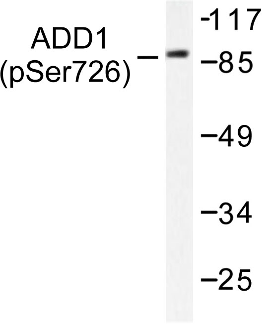 ADD1 / Adducin Alpha Antibody - Western blot of p-Adducin alpha / beta (S726/713) pAb in extracts from 293 cells.