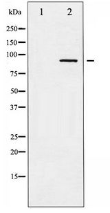 ADD1 / Adducin Alpha Antibody - Western blot of ADD1 phosphorylation expression in Forskolin treated HeLa whole cell lysates,The lane on the left is treated with the antigen-specific peptide.