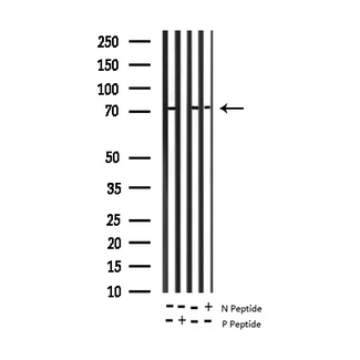 ADD1 / Adducin Alpha Antibody - Western blot analysis of Phospho-ADD1 (Ser726) expression in various lysates