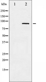 ADD1 / Adducin Alpha Antibody - Western blot analysis of ADD1 phosphorylation expression in Forskolin treated HeLa whole cells lysates. The lane on the left is treated with the antigen-specific peptide.