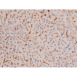 ADD1 / Adducin Alpha Antibody - 1:200 staining mouse liver tissue by IHC-P. The tissue was formaldehyde fixed and a heat mediated antigen retrieval step in citrate buffer was performed. The tissue was then blocked and incubated with the antibody for 1.5 hours at 22°C. An HRP conjugated goat anti-rabbit antibody was used as the secondary.