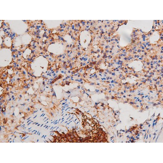 ADD1 / Adducin Alpha Antibody - 1:200 staining mouse lung tissue by IHC-P. The tissue was formaldehyde fixed and a heat mediated antigen retrieval step in citrate buffer was performed. The tissue was then blocked and incubated with the antibody for 1.5 hours at 22°C. An HRP conjugated goat anti-rabbit antibody was used as the secondary.