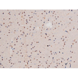 ADD1 / Adducin Alpha Antibody - 1:200 staining mouse lung tissue by IHC-P. The tissue was formaldehyde fixed and a heat mediated antigen retrieval step in citrate buffer was performed. The tissue was then blocked and incubated with the antibody for 1.5 hours at 22°C. An HRP conjugated goat anti-rabbit antibody was used as the secondary.