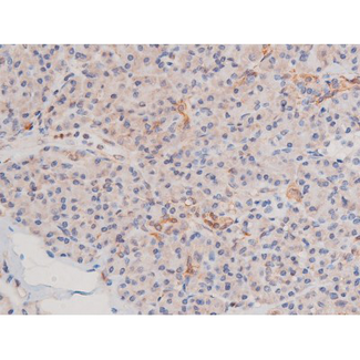 ADD1 / Adducin Alpha Antibody - 1:200 staining mouse pancreas tissue by IHC-P. The tissue was formaldehyde fixed and a heat mediated antigen retrieval step in citrate buffer was performed. The tissue was then blocked and incubated with the antibody for 1.5 hours at 22°C. An HRP conjugated goat anti-rabbit antibody was used as the secondary.
