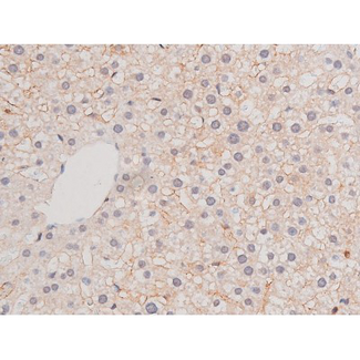 ADD1 / Adducin Alpha Antibody - 1:200 staining rat liver tissue by IHC-P. The tissue was formaldehyde fixed and a heat mediated antigen retrieval step in citrate buffer was performed. The tissue was then blocked and incubated with the antibody for 1.5 hours at 22°C. An HRP conjugated goat anti-rabbit antibody was used as the secondary.