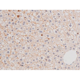 ADD1 / Adducin Alpha Antibody - 1:200 staining rat liver tissue by IHC-P. The tissue was formaldehyde fixed and a heat mediated antigen retrieval step in citrate buffer was performed. The tissue was then blocked and incubated with the antibody for 1.5 hours at 22°C. An HRP conjugated goat anti-rabbit antibody was used as the secondary.