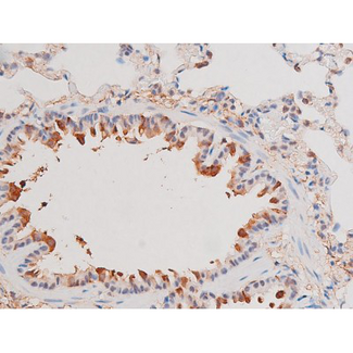 ADD1 / Adducin Alpha Antibody - 1:200 staining rat lung tissue by IHC-P. The tissue was formaldehyde fixed and a heat mediated antigen retrieval step in citrate buffer was performed. The tissue was then blocked and incubated with the antibody for 1.5 hours at 22°C. An HRP conjugated goat anti-rabbit antibody was used as the secondary.